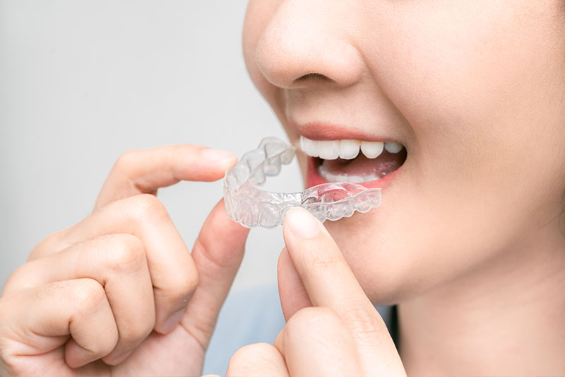 Orthodontics in Costa Mesa